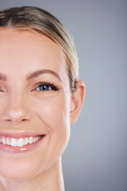 Imagen de Blanqueamiento Dental