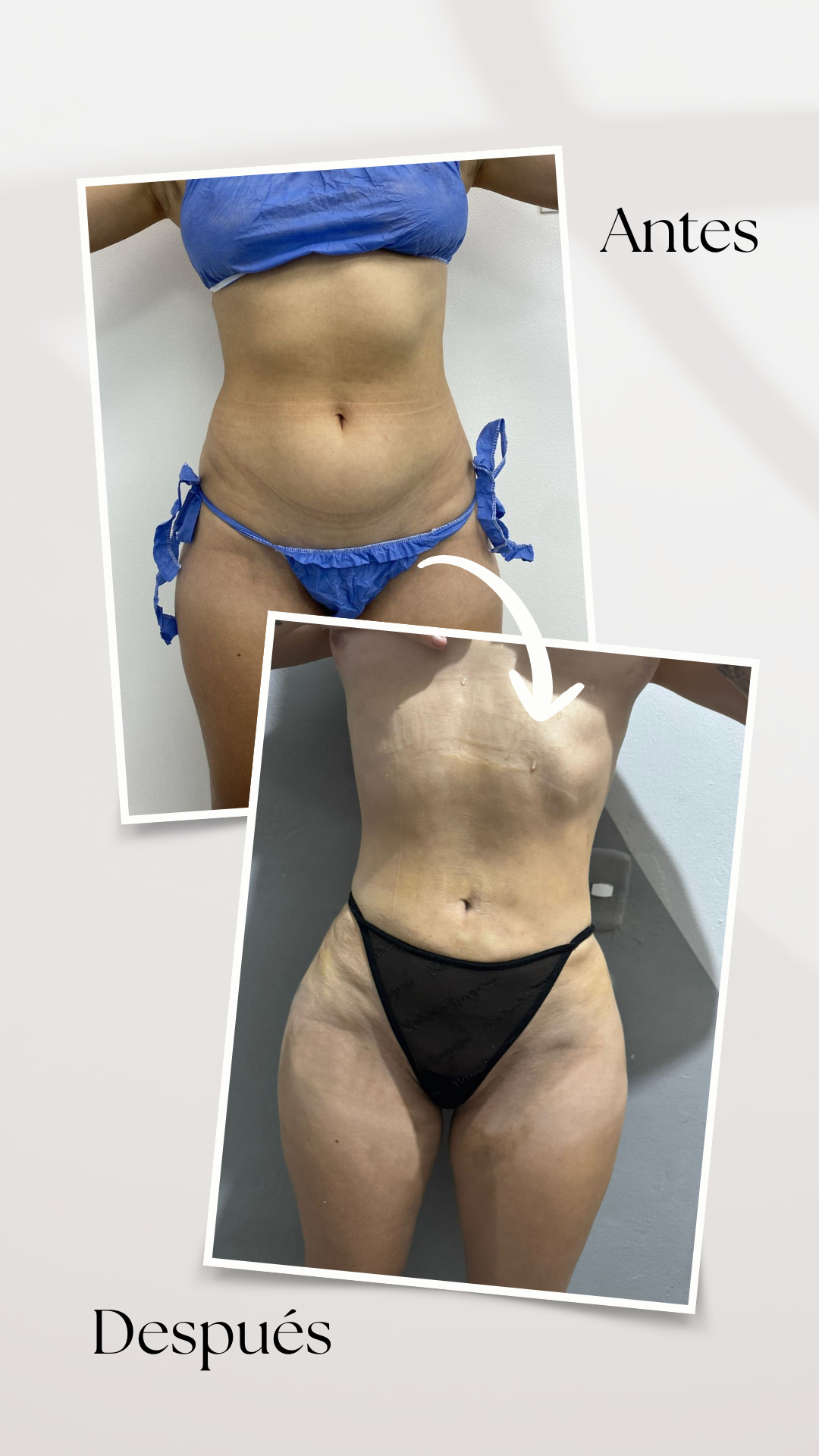 Resultado 2 - IPS Damar Esthetic