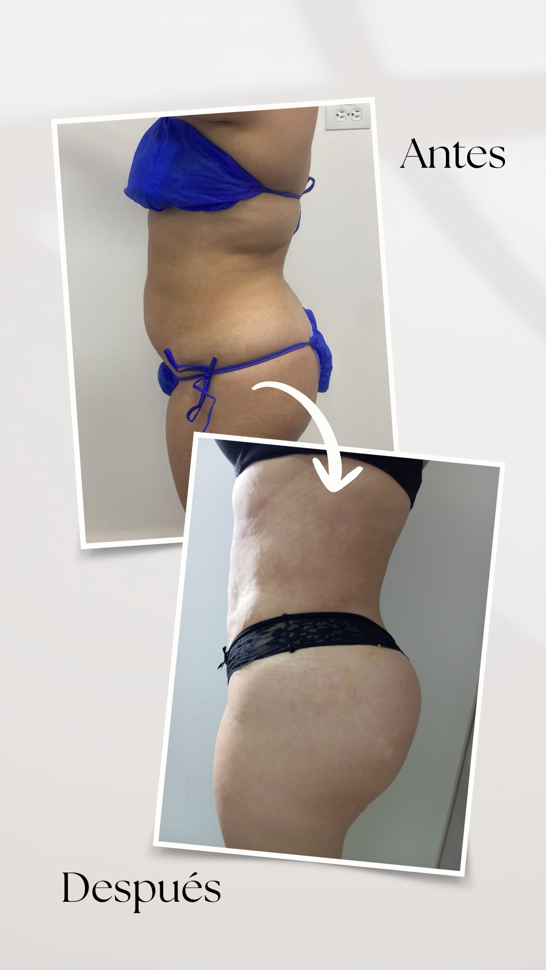 Resultado 1 - IPS Damar Esthetic